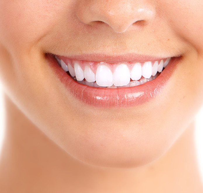 beautiful white teeth after whitening
